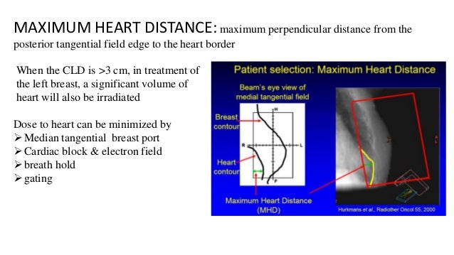 maximum radiation dose for breast cancer Amatuer bride porn